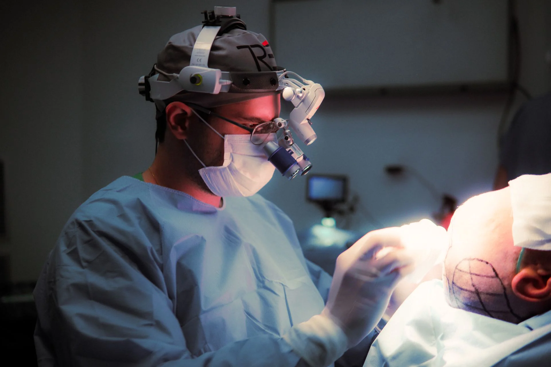 ein Arzt, der eine Haartransplantations-Reparatur durchführt